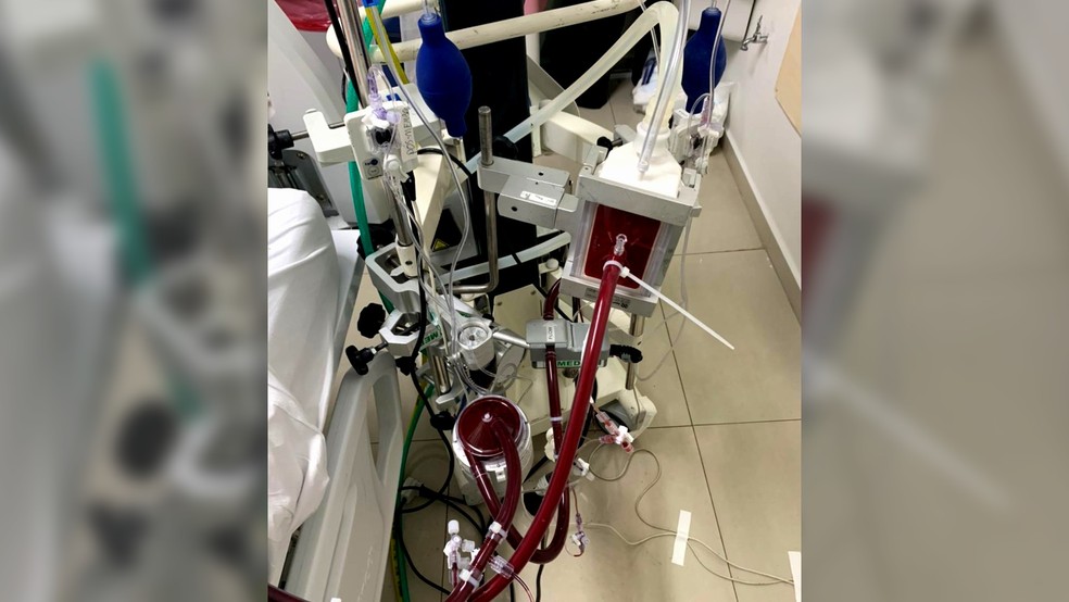 Covid-19: Hospital de Curitiba usa máquina que oxigena o sangue enquanto pulmão 'descansa' para salvar pacientes mais graves