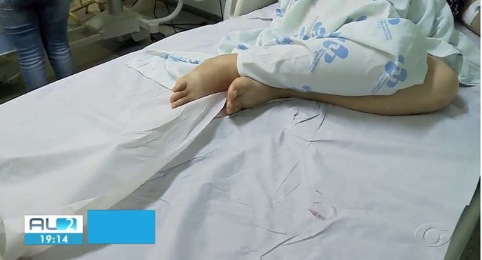 Camas de pacientes com câncer do HU de Maceió são forradas com papel  — Foto: Reprodução/TV Gazeta