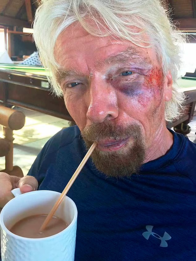 Richard Branson já havia sofrido uma grande queda em 2016 (Foto: divulgação)