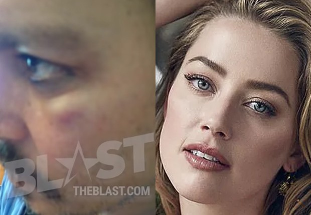 Amber Heard e Johnny Depp. As alegações de agressões sucedem-se