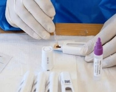 Brasileiros atestam eficácia de 3 novos testes sorológicos para Covid-19