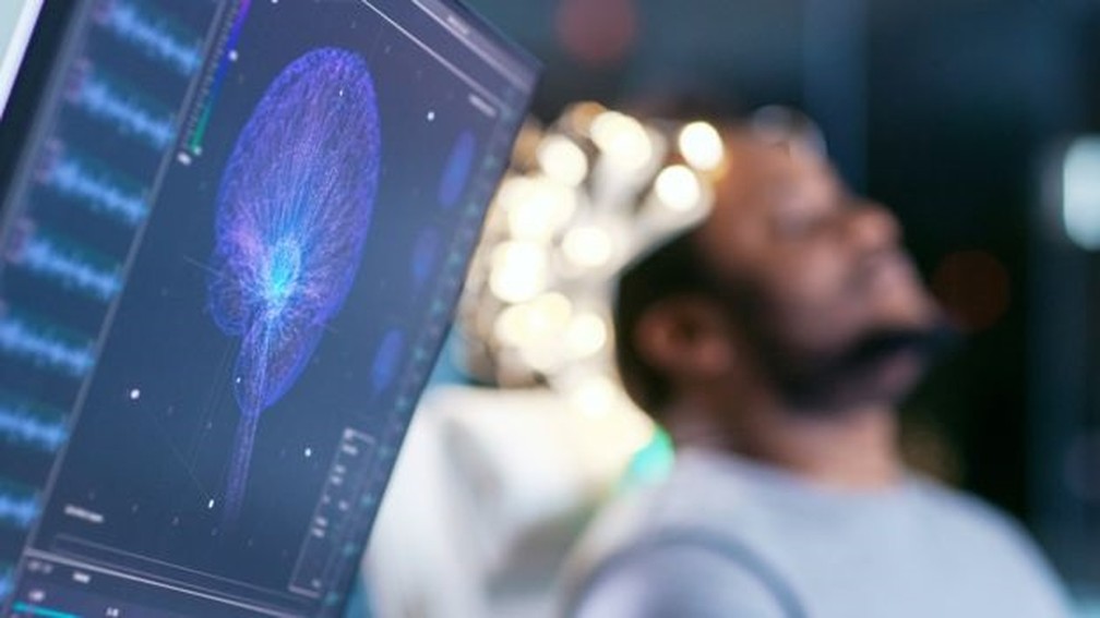 Graças às novas tecnologias médicas, hoje podemos ver como o cérebro funciona. — Foto: Getty Images