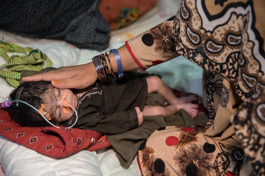 Um bebê de dois meses recebe tratamento para desnutrição aguda em hospital do Médicos Sem Fronteiras, em Lashkar Gah, no Afeganistão