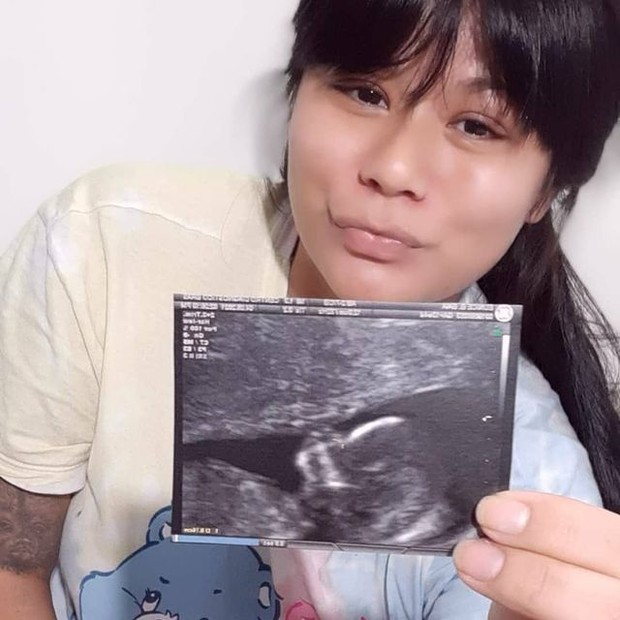 Eunice Baía anuncia gravidez (Foto: Reprodução/Instagram)