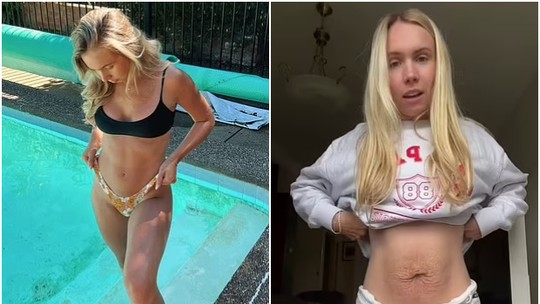 Mãe de 24 anos compartilha vídeo poderoso mostrando realidade do corpo pós-parto