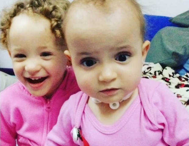 As gêmeas Ayla e Allana (Foto: Arquivo pessoal)