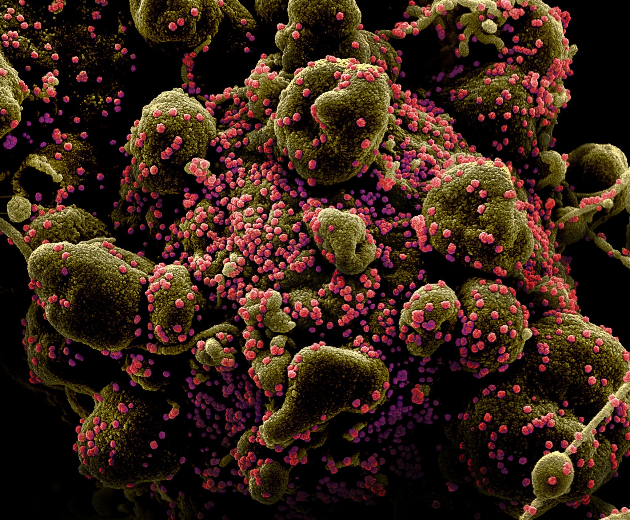 Foto mostra o vírus Sars-CoV-2 (pontinhos) na superfície de uma célula humana (estrutura maior) (Foto: NIAID)