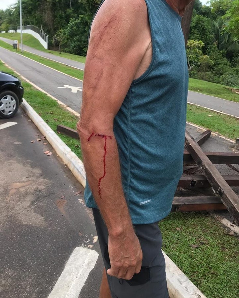 Homens ficaram feridos após estrutura de madeira cair — Foto: Círio Júnior/Arquivo Pessoal