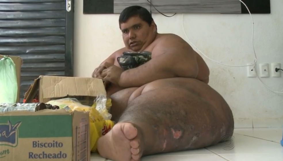 Carlinhos em 2015, quando tinha mais de 400 quilos — Foto: Reprodução/TV Paraíba