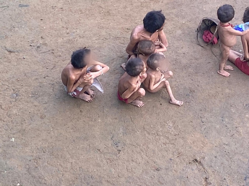 Crianças são as mais afetadas por doenças na Terra Indígena Yanomami — Foto: Condisi-YY/Divulgação
