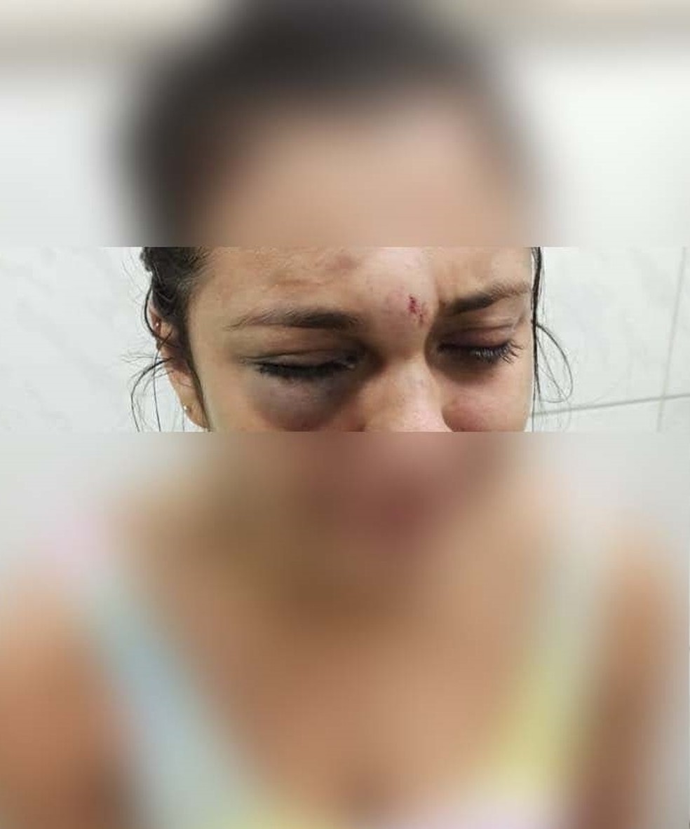 Jovem relata ter sofrido agressões por parte do namorado em São Vicente, litoral paulista — Foto: Reprodução/Facebook