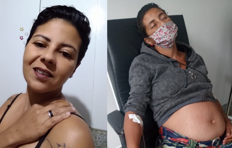 Mulher com tumor gigante é confundida com grávida e busca por cirurgia: Não aguento mais dor