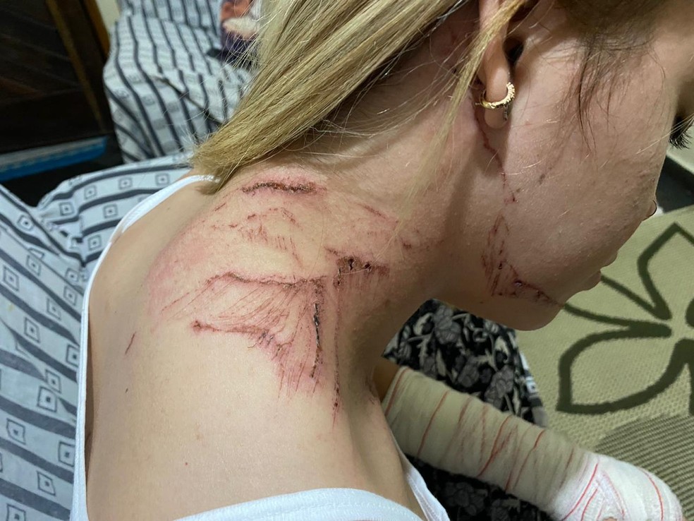 Giovanna teve arranh&otilde;es e cortes superficiais no pesco&ccedil;o ap&oacute;s acidente &mdash; Foto: Arquivo Pessoal
