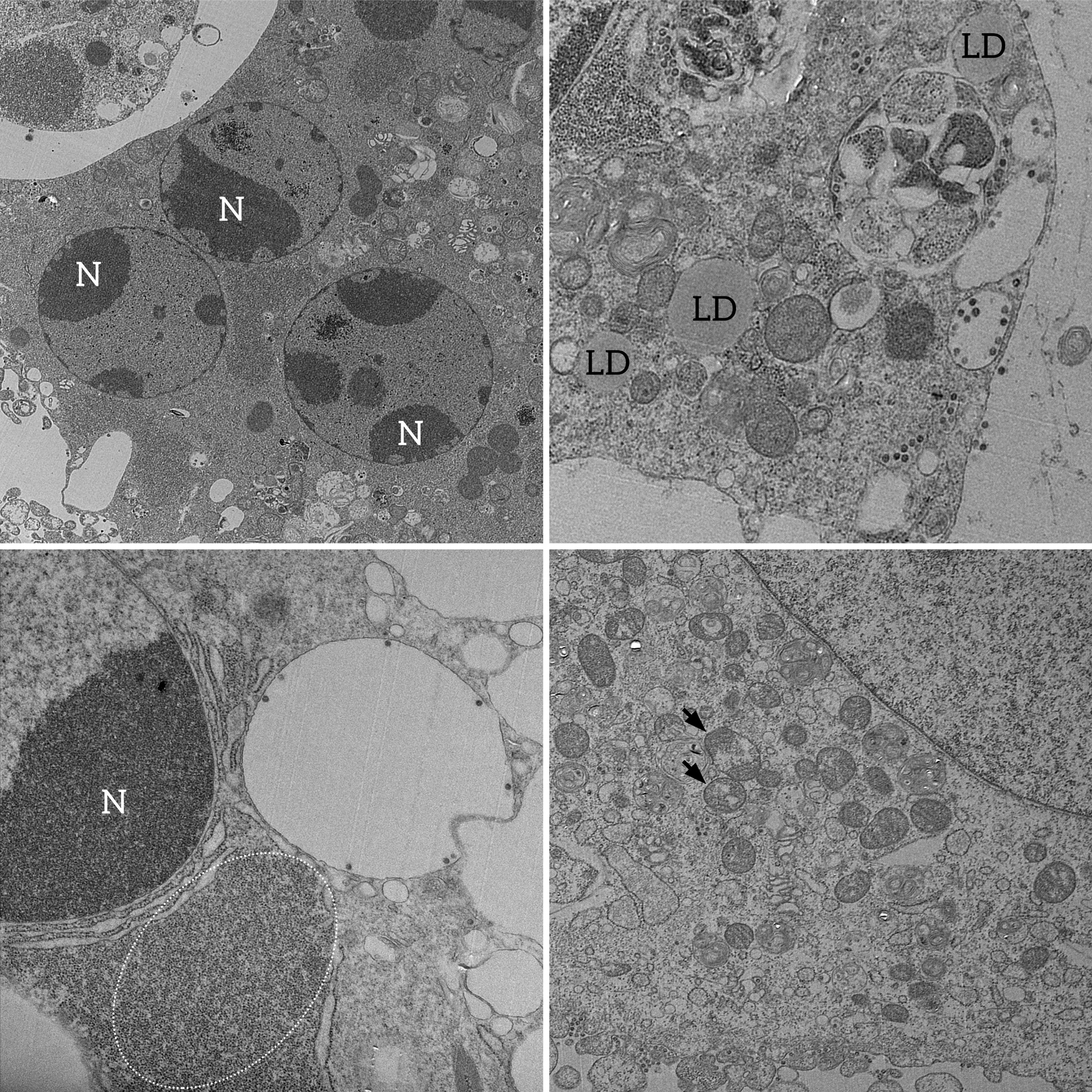 Imagens mostram processo celular que leva à replicação viral do Sar-CoV-2 (Foto: Barreto-Vieira et al; Viruses)