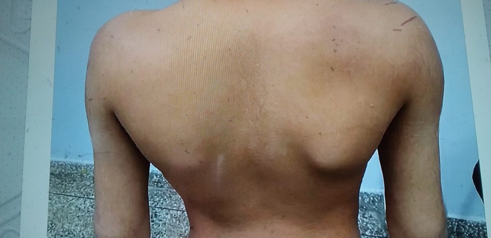 Menino torturado em Manaus está abaixo do peso — Foto: Reprodução