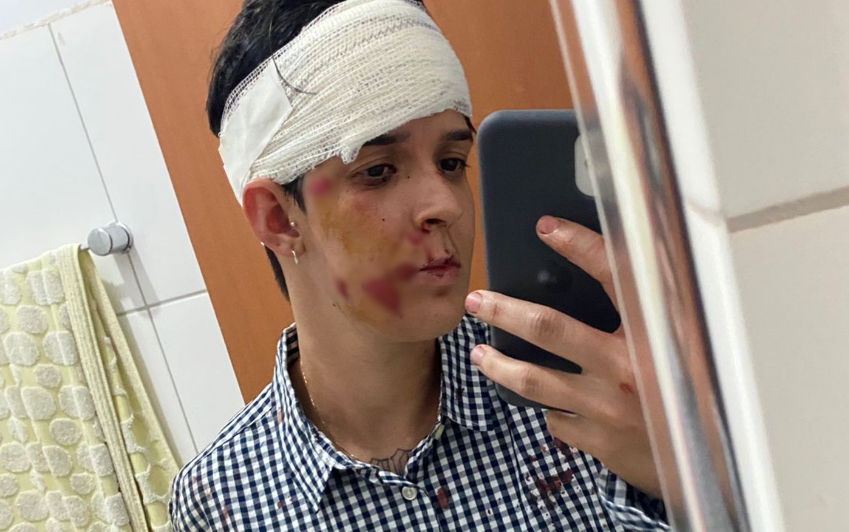 Jovem denuncia que foi agredida e teve dois dentes quebrados em festival de Goiânia