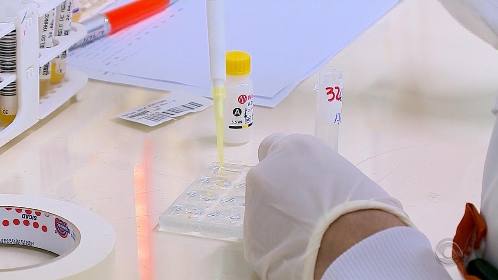 Números de casos de toxoplasmose em Santa Maria é o maior já registrado no RS (Foto: Reprodução/RBSTV)