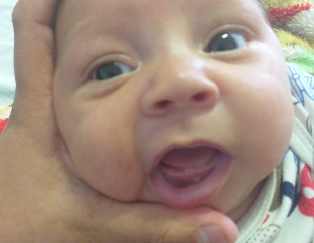 O pequeno Levi com um mês e dois dentinhos (Foto: Arquivo pessoal)