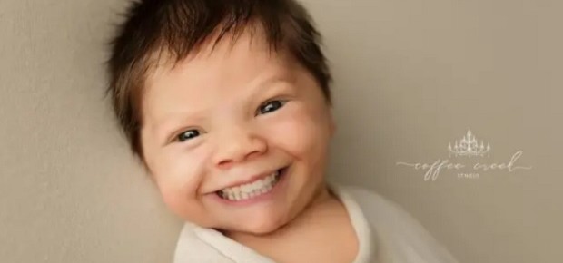 Fotógrafa mostra recém-nascidos como se eles tivessem dentes  (Foto: Reprodução)