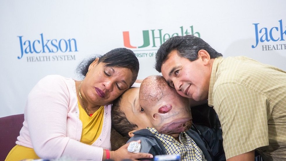 Emanuel tinha rara condio gentica que provocava formao de tumores (Foto: David Sutta Photography/BBC)