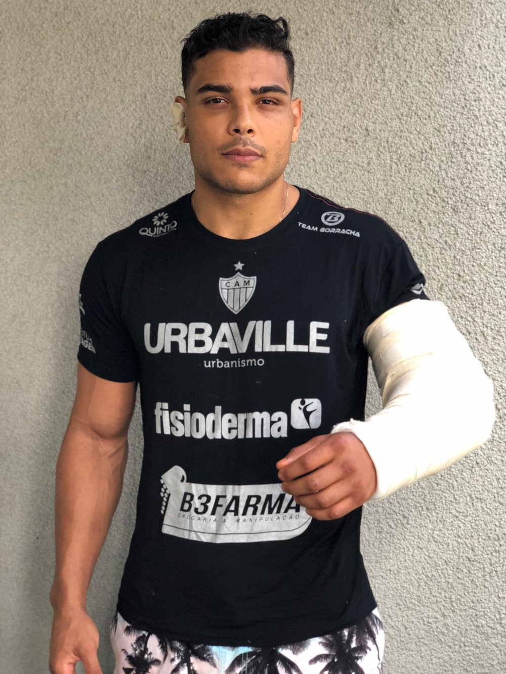 News - Paulo costa has biceps and ear surgery, teases adesanya and takes  shots at romero: "He wasnt clean" | Page 4 | Sherdog Forums | UFC, MMA &  Boxing Discussion