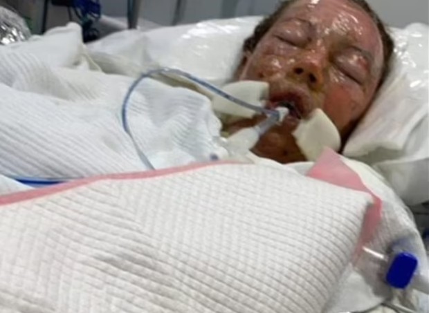 Mãe acorda de coma induzido e descobre que parceiro morreu em acidente (Foto: Reprodução Daily Mail )