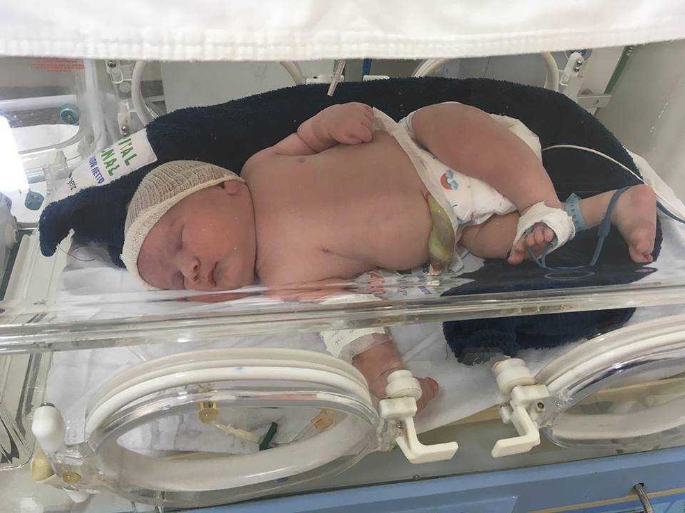 Rafael nasceu com 5.720 gramas e 54 cm de estatura — Foto: Divulgação/Arquivo pessoal
