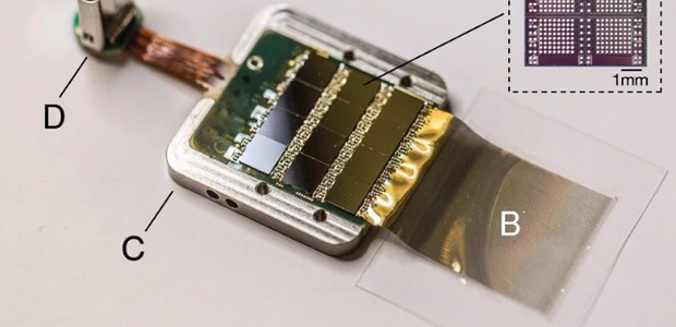 Chip implantado no cérebro permitirá controlar máquinas com pensamento (Foto: Divulgação/Neuralink)