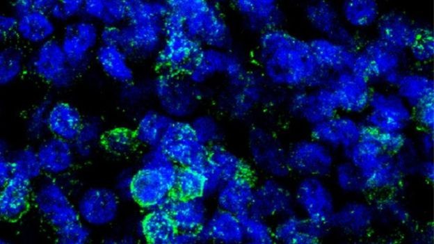 Minicérebros são feitos a partir de células da pele ou urina, induzidas em laboratório a voltarem ao estágio de células-tronco (Foto: Idor/via BBC News Brasil)