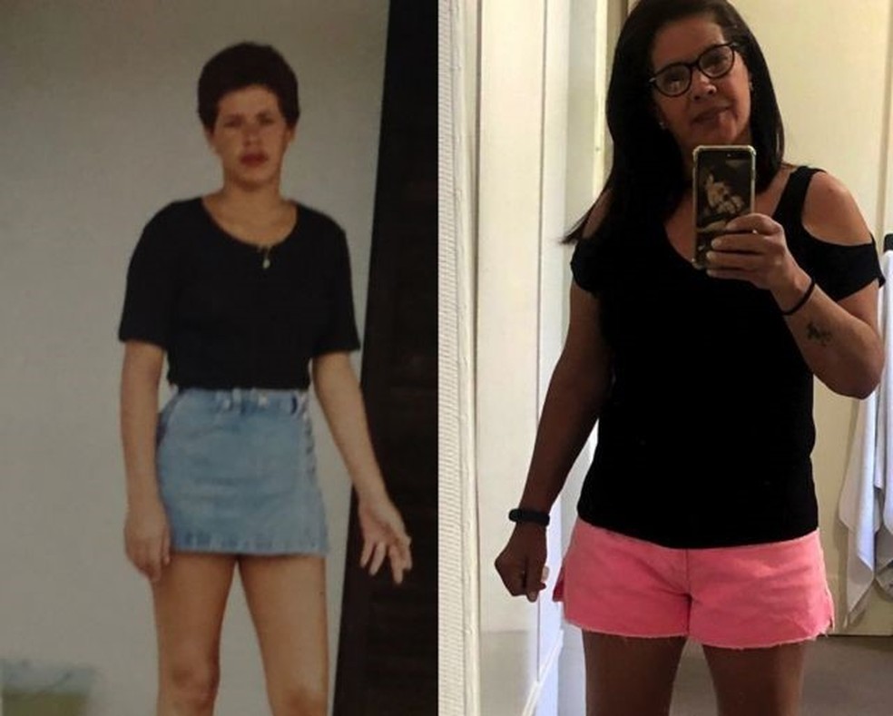 Silvana Madeira, hoje com 56 anos, buscou ajuda médica aos 19 para entender por que, com 1,63m, não conseguia pesar mais do que 49 quilos — Foto: Arquivo Pessoal