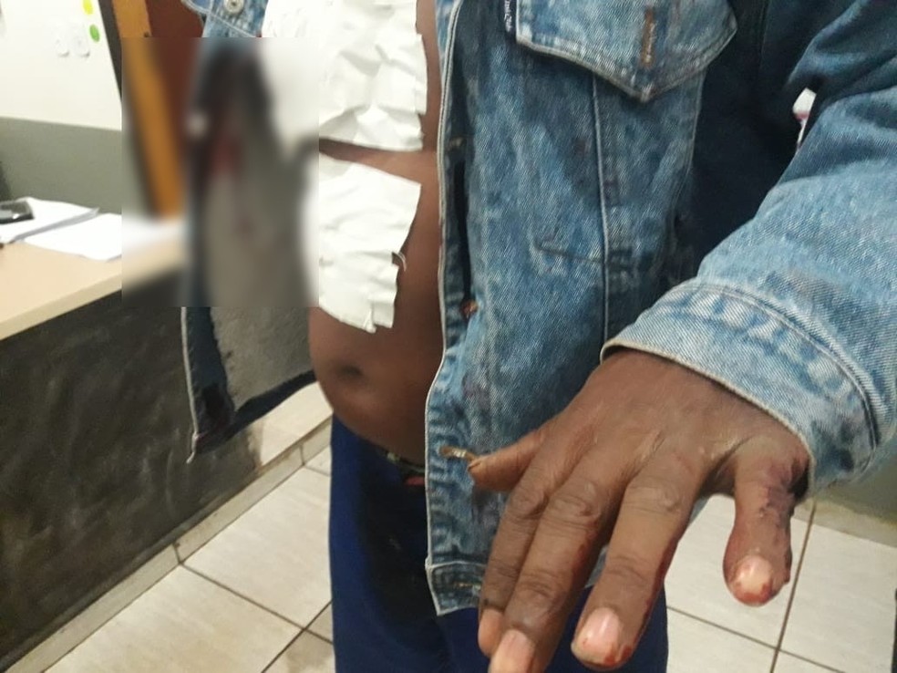 Suspeito de matar homem foi atingido com um golpe de faca. Ele recebeu atendimento m&Atilde;&copy;dico e foi levado para a delegacia. (Foto: Site Rio Brilhante em Tempo Real / Olimar Gamarra)