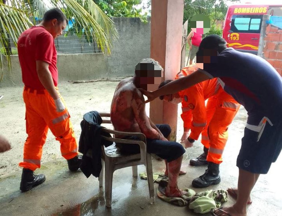 Homem foi socorrido pelos bombeiros com queimaduras de 2º grau nos membros superiores, inferiores e nas costas. — Foto: Corpo de Bombeiros/ Divulgação