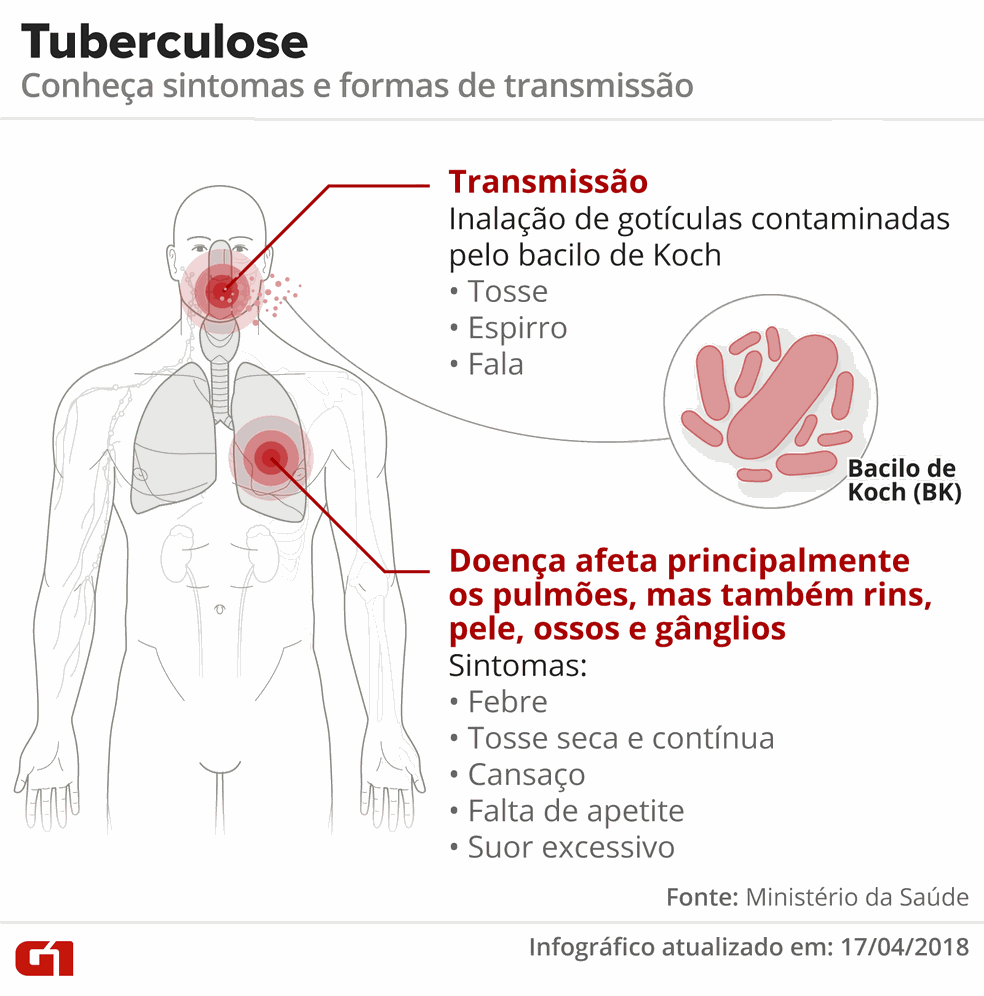 Tuberculose: entenda os sintomas (Foto: Alexandre Mauro/G1)