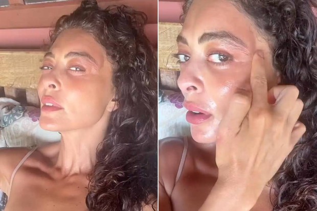 Juliana Paes mostra rosto inchado  (Foto: Reprodução/Instagram)
