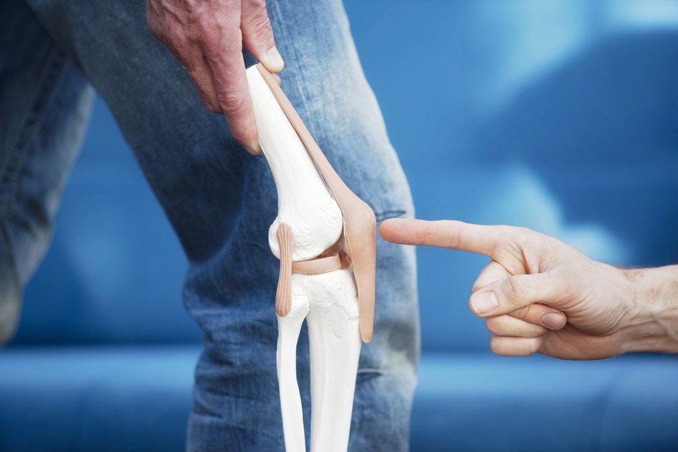Médico aponta para a patela: condromalácia é caracterizada pelo amolecimento da cartilagem por trás dessa rótula — Foto: Istock Getty Images