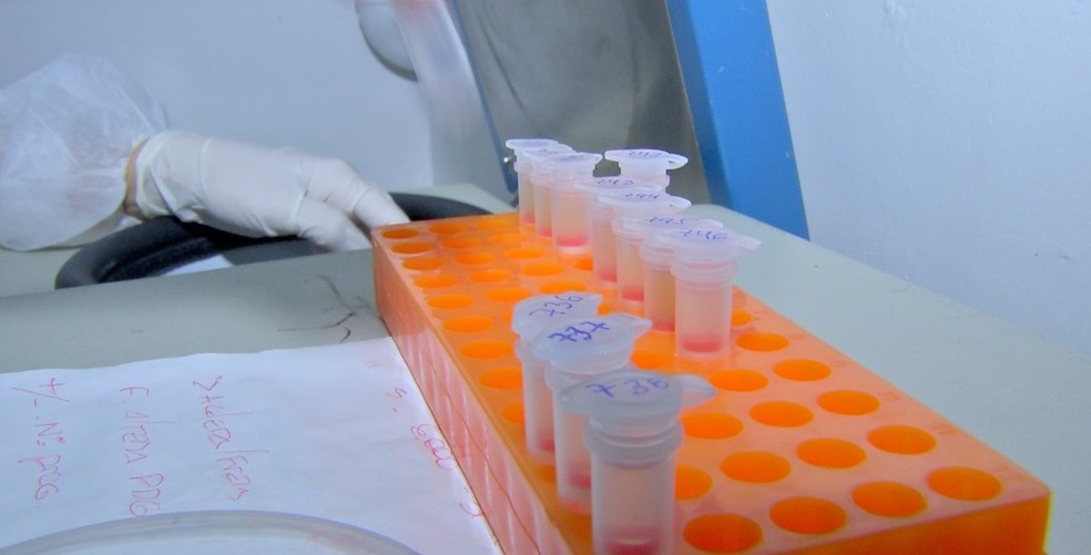 Sobe para 13 nº de casos confirmados do coronavírus na Bahia, diz Secretaria de Saúde — Foto: TVCA/Reprodução