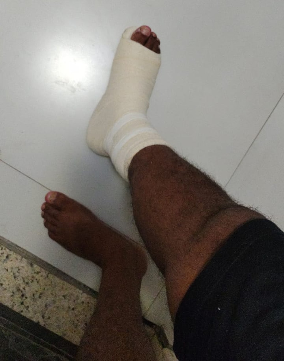 Paulo Arifa sofreu uma torção no pé direito após empurrão em shopping — Foto: Arquivo pessoal