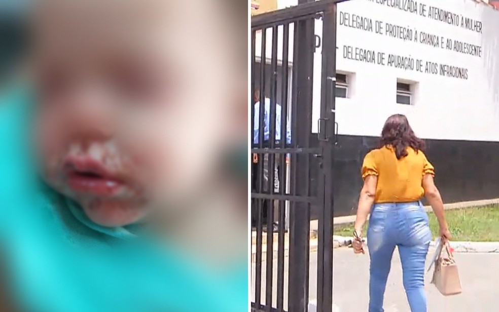 Mulher suspeita de jogar soda cáustica em jovem e crianças na porta de bar é indiciada por tentativa de homicídio qualificado