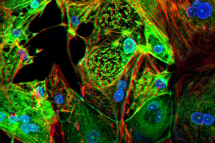 Estudo conclui que células musculares cardíacas humanas (vermelhas) são infectadas com Sars-CoV-2 (verde). (Foto: Lina Greenberg)