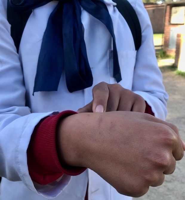 Menino mostra cortes na mão, depois de participar de desafio com outros colegas, em escola em Montevidéu (Foto: Reproduçãp/El Espectador)