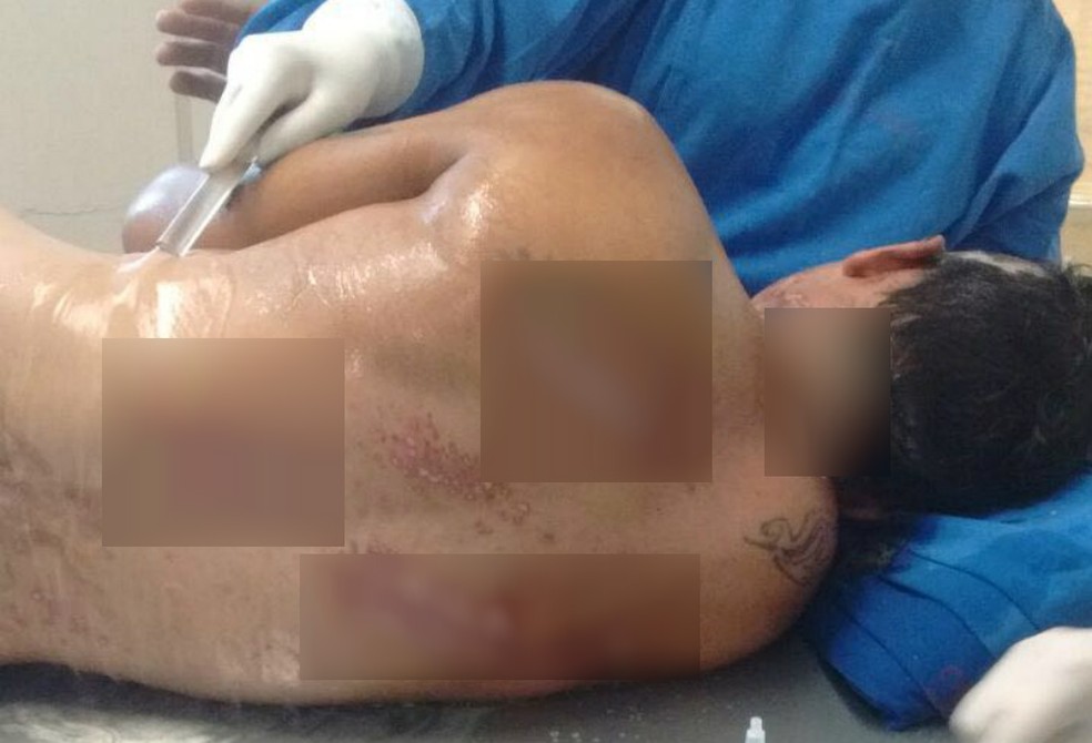 Homem sobreviveu a choque de 30 mil volts, diz famÃ­lia em Campo Grande - MS â Foto: JoÃ£o Paulo Souza/Arquivo Pessoal