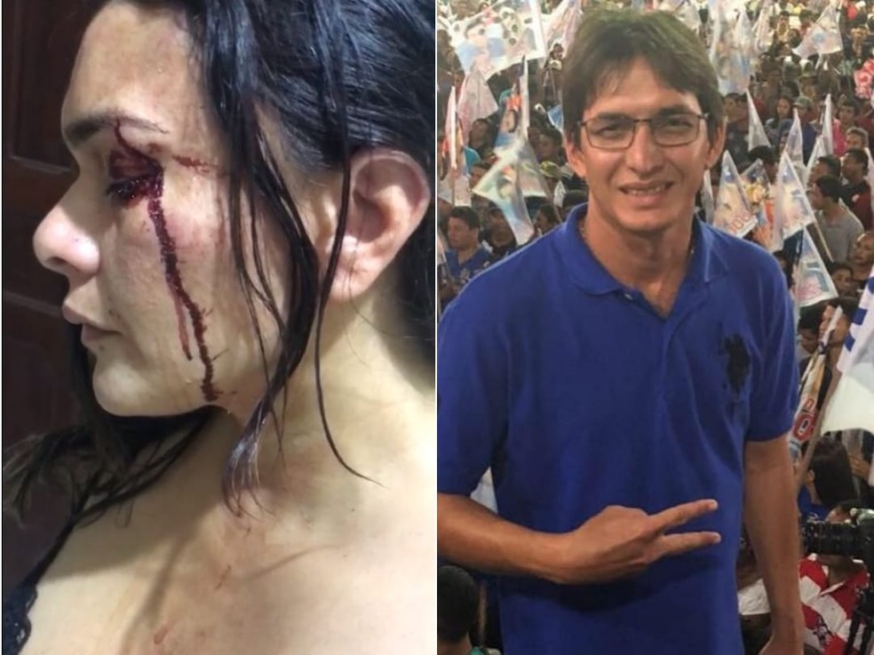 Ex-candidato a prefeito de cidade do Maranhão é suspeito de agredir a ex-mulher: “ele não aceitou a separação” — Foto: Divulgação/Redes sociais