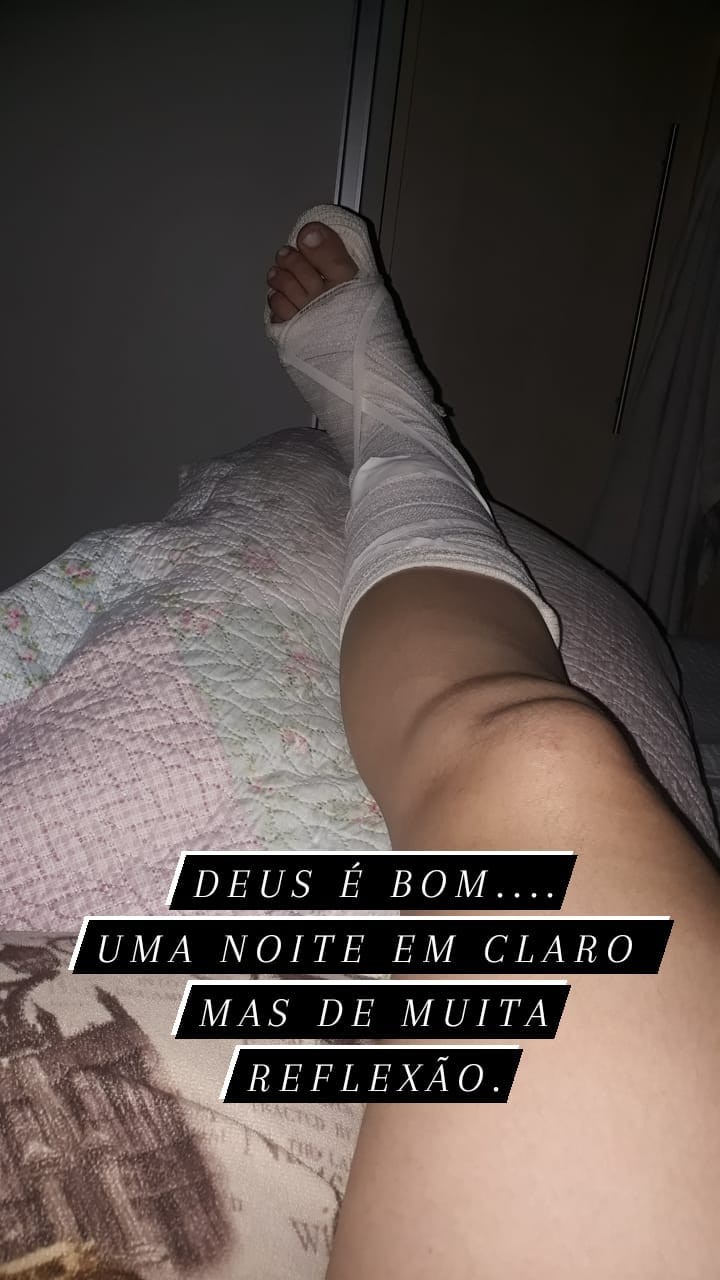 Aline Oliveira sofre acidente (Foto: Reprodução/Instagram)