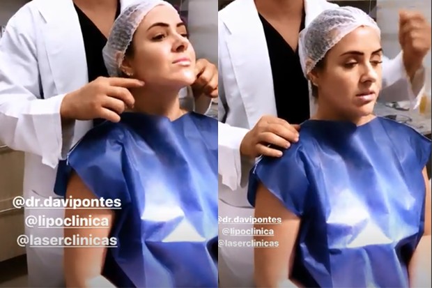 Patricia Leitte faz harmonização facial (Foto: Reprodução/Instagram)