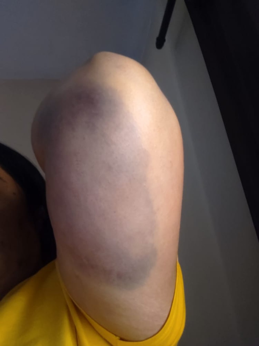 Vítima foi agredida por companheiro em Taubaté — Foto: Arquivo Pessoal