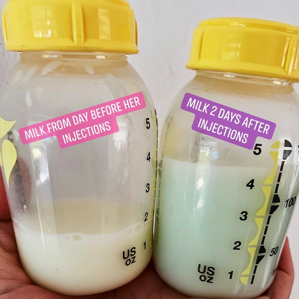 A britânica Jody Fisher compartilhou o antes e depois do seu leite, após sua filha ser imunizada (Foto: Facebook/Reprodução)
