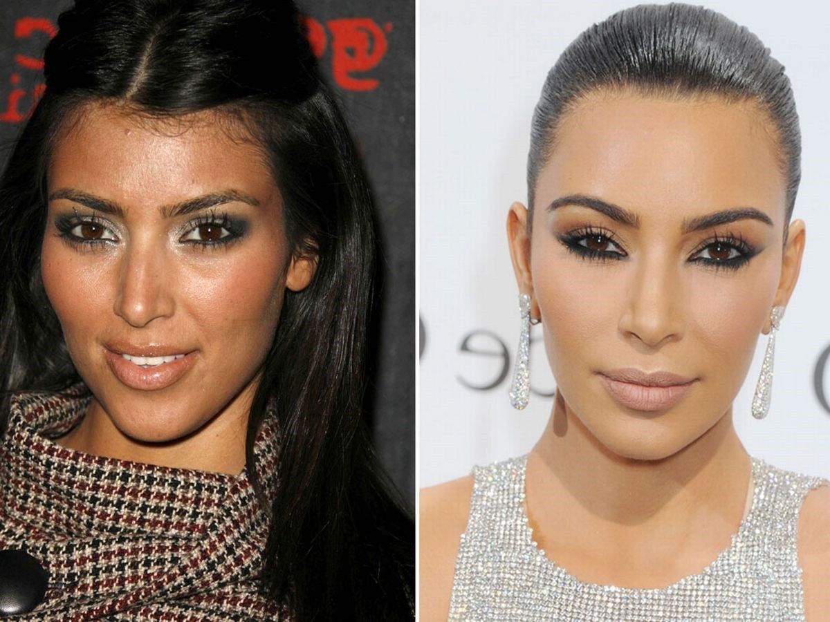 Antes e depois de Kim Kardashian (Foto: Reprodução)