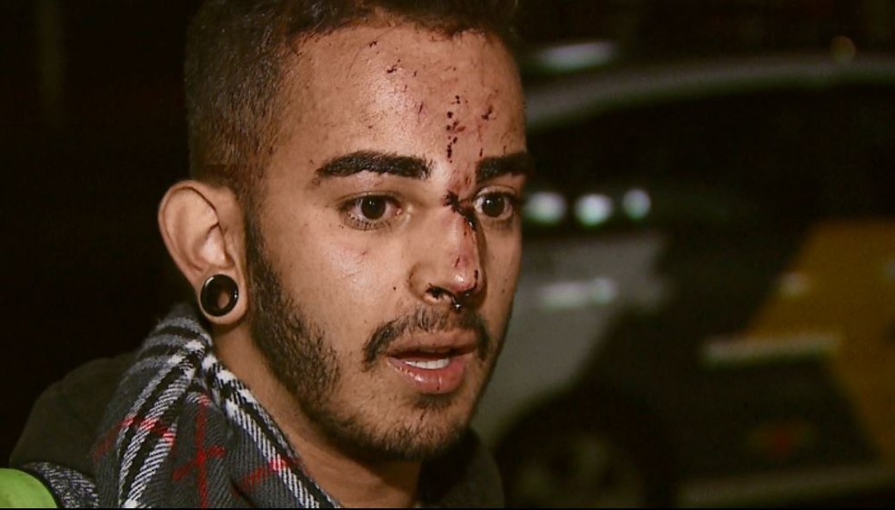 Rafael teve cortes pelo rosto e tentou salvar amigos presos em ferragens â Foto: Ely Venancio/EPTV