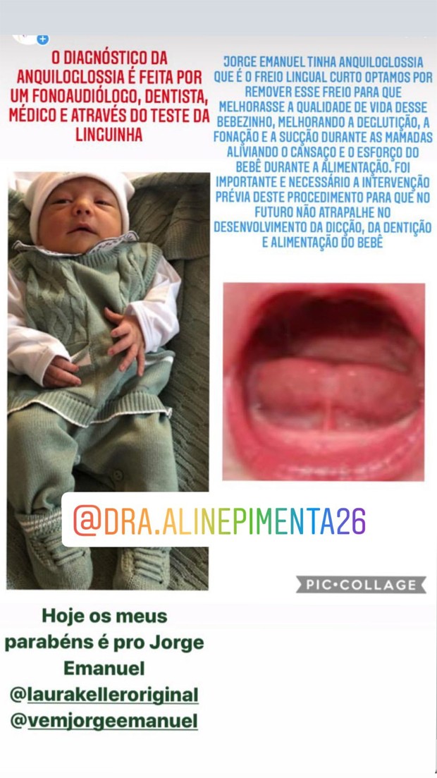 Laura Keller mostra procedimento sendo feito na língua do filho, Jorge Emanuel (Foto: Reprodução / Instagram)