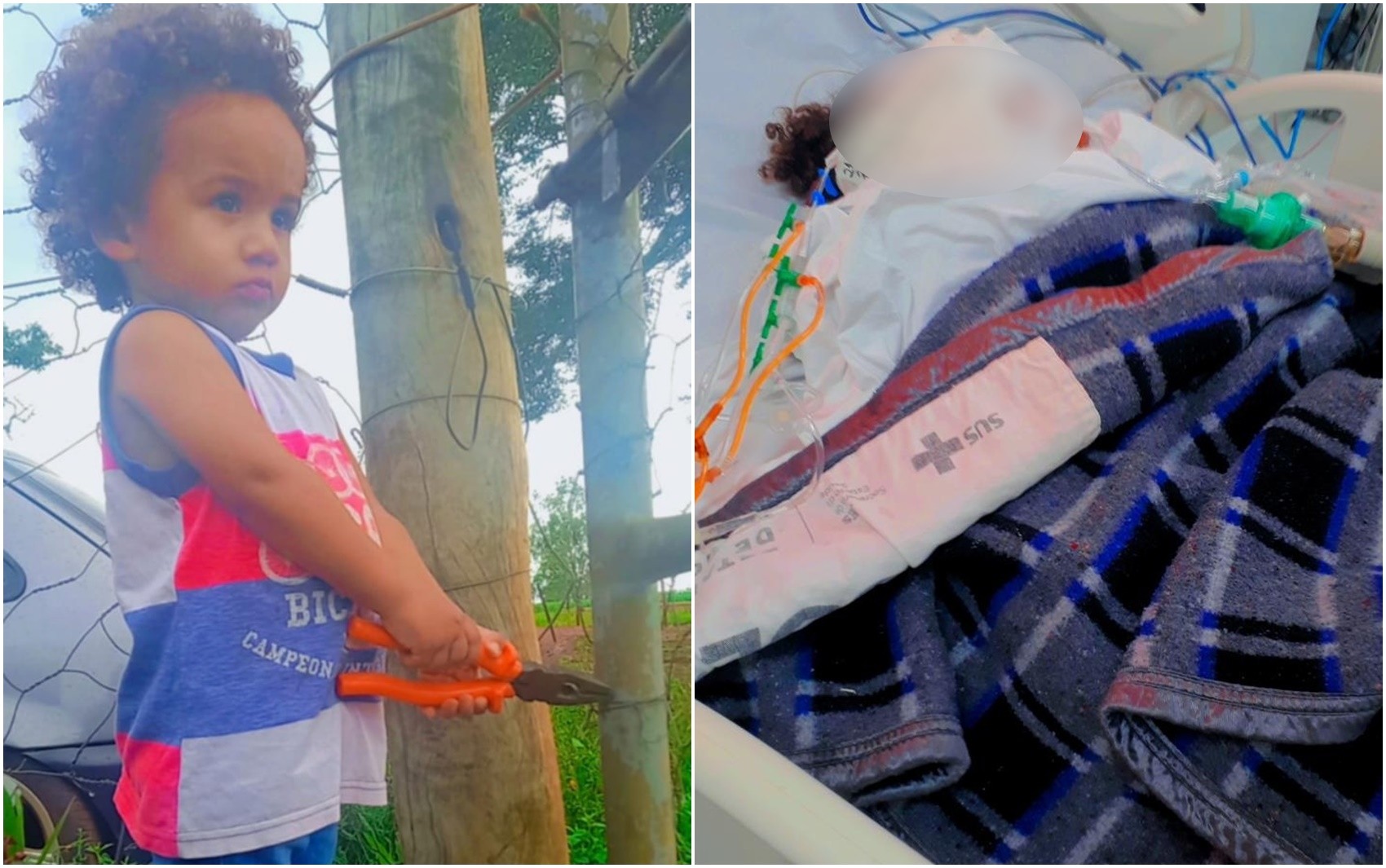 Bebê é internado com corpo queimado após panela com água quente cair sobre ele